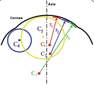 Diagnostic Approach of Corneal Topography Maps | Ento Key