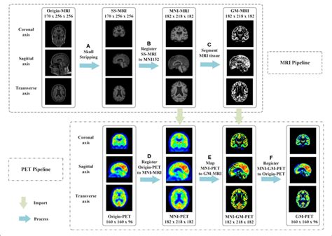 Proposed Multimodal Image Fusion Method In The Mri Pipeline We Download Scientific Diagram