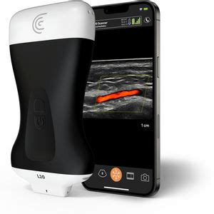 Ecógrafo de mano C3 HD3 Clarius Mobile Health para ecografía