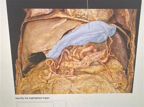 Solved Identify The Highlighted Organ Which Cells Of T