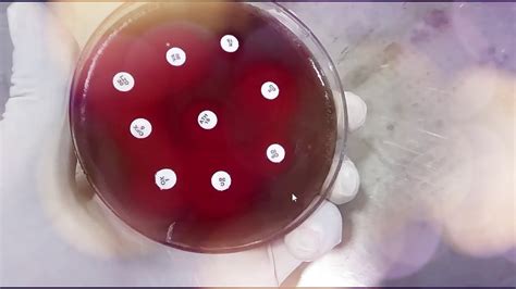 Optochin Streptococcus Pneumoniae Viridans Spreptococci YouTube