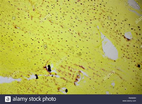 Human Bone Cells Under Microscope