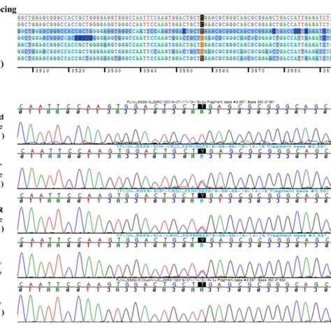 | Reverse DNA sequencing chromatogram of the patients and his family ...