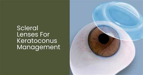 Scleral Lenses For Keratoconus Management Boneham Optometrist