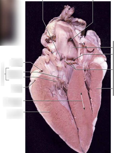 Left atrioventricular valve Diagram | Quizlet