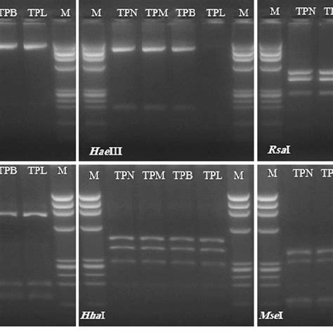 Actual RFLP Analyses Of 1 25 Kb Of 16S RDNA Nested PCR Products Of TP