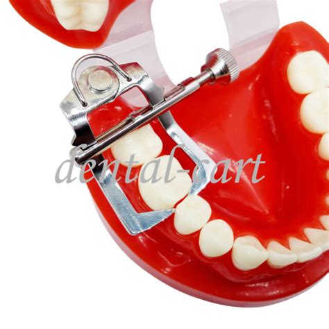 Dental Tooth Divider Retractor Mouth Gag Oral Mouth Opener Separator