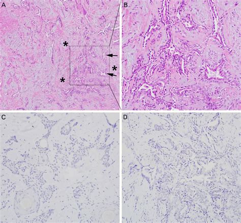 A B Hematoxylin And Eosin Stained Sections Shows Many Glandular Download Scientific Diagram