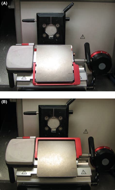 Figure 3 From Cryostat Injury With Distal Finger Amputation Repaired