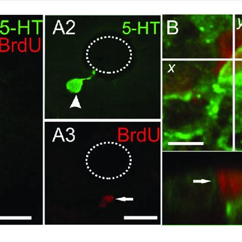 | Double labeling with anti-5-HT and the proliferating cell markers (A ...