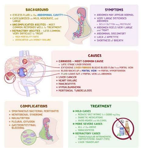 Ascites - MEDizzy