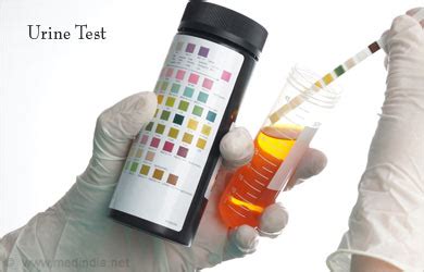 Urinary Diversion - Indications, Types, Procedures, Diagnosis, Postoperative Care