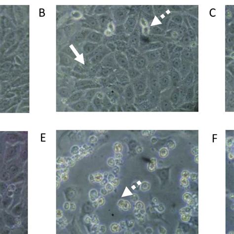 The T47d Cells Morphology A With Dox Untreated B Treated With Dox