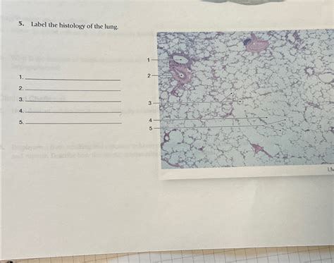 Solved Label the histology of the lung. | Chegg.com