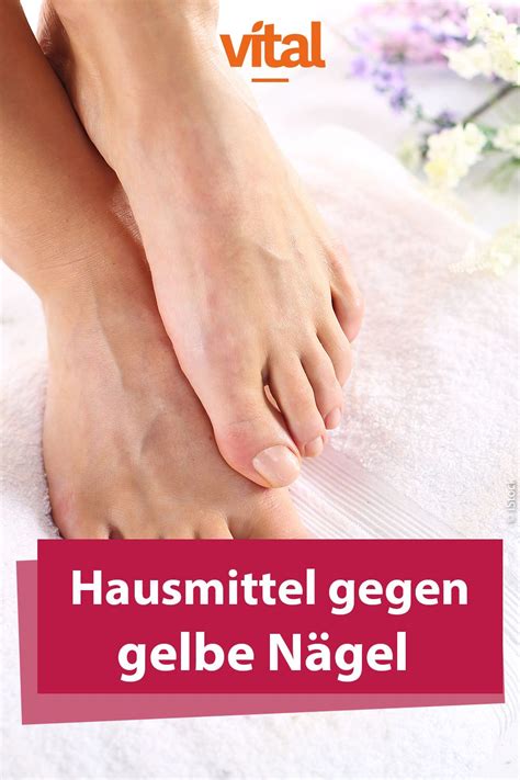 Gelbe Fingernägel Ursachen und Hausmittel Gelbe nägel Fußnägel