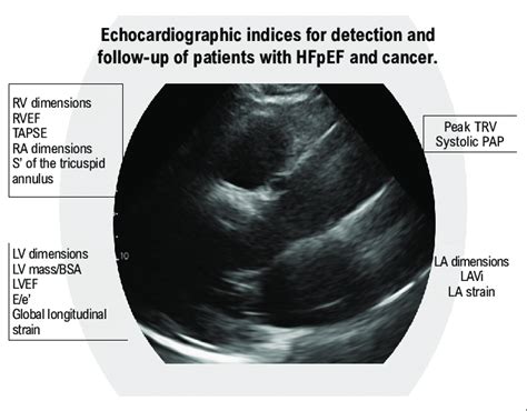 Echocardiographic Indices For Detection And Follow Up Of Patients With