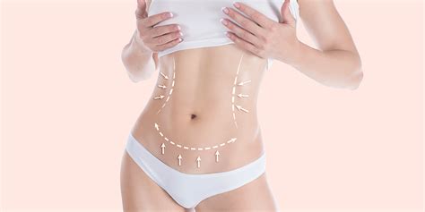 Mini abdominoplastia tudo que você precisa saber sobre o procedimento