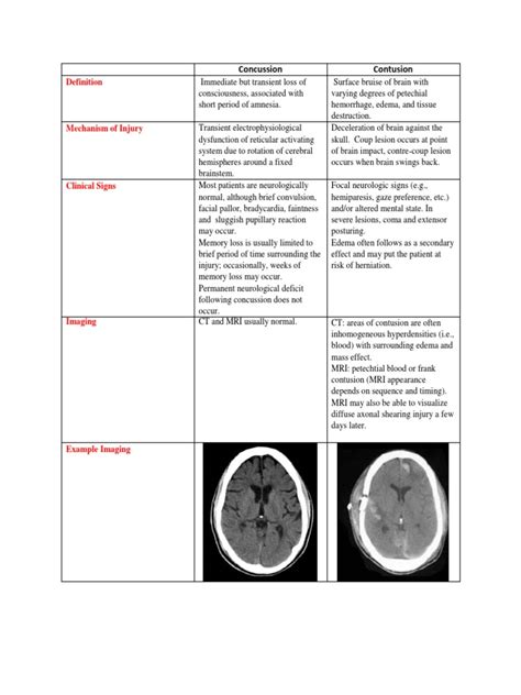 Concussion Vs Contusion | PDF | Concussion | Neuroscience