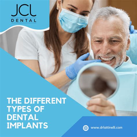 Different Types Of Dental Implants In Manhattan Dental Office Near