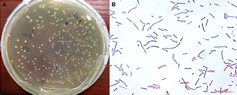 Lactobacillus Morphology