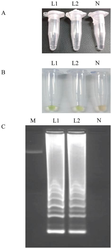 LAMP Detection Of Loa Loa Genomic DNA Samples A By The Naked Eye