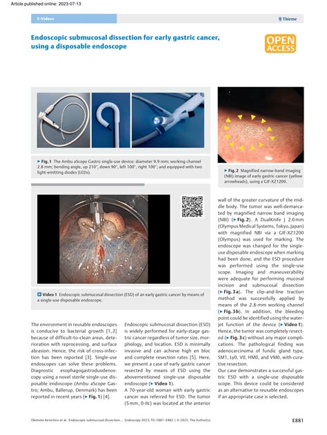 Pdf Endoscopic Submucosal Dissection For Early Gastric Cancer Using