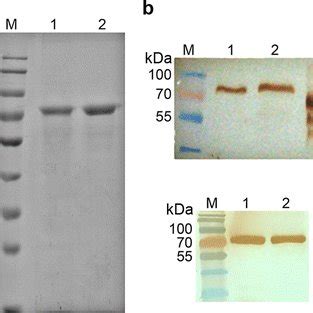 SDS PAGE And Western Blot Analysis Of Purified Fusion Proteins A