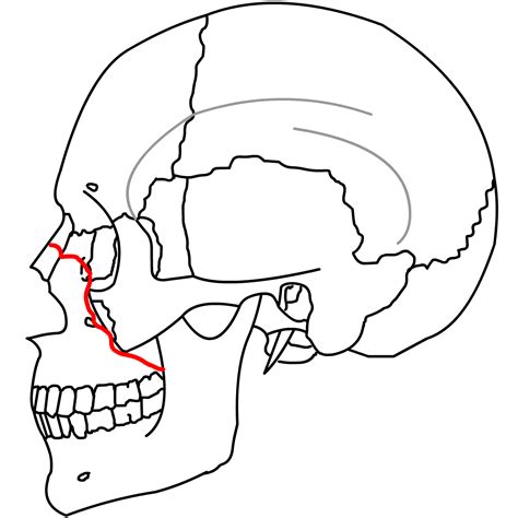 Maxillofacial Trauma Wikidoc