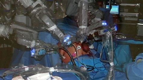 Health Beat Robotic Whipple Procedure For Pancreatic Cancer Health