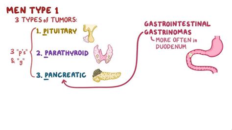 Clinical Reasoning Men Syndromes Osmosis