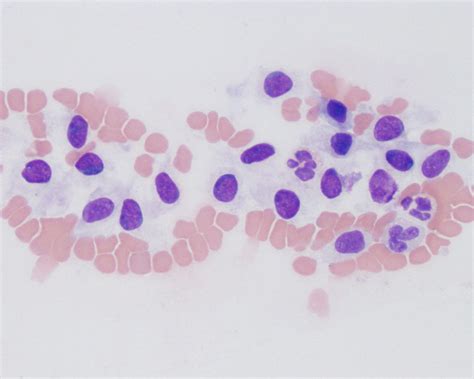 Hematology Eclinpath