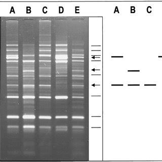 Lr Rep Pcr Fingerprint Patterns Of Representative Bacillus Species The