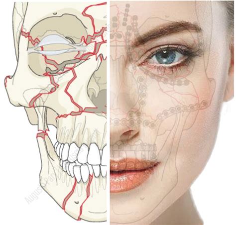 Trauma De Face Augusto Pary