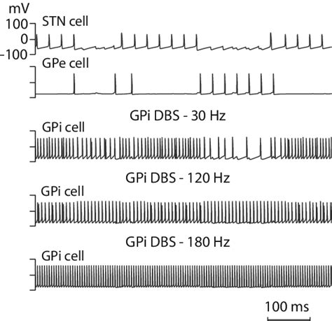 Membrane Potentials Of One STN One GPe And One GPi Cell During GPi