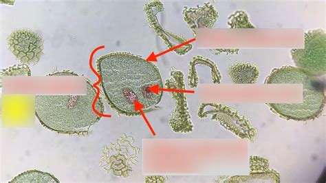 Label Pollen Grain Diagram | Quizlet