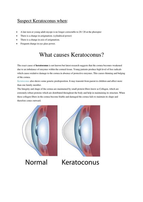 Ppt Keratoconus Treatment In India Powerpoint Presentation Free