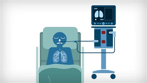 Coronavirus Heres Why Respirators And Intubation Are Needed To Treat