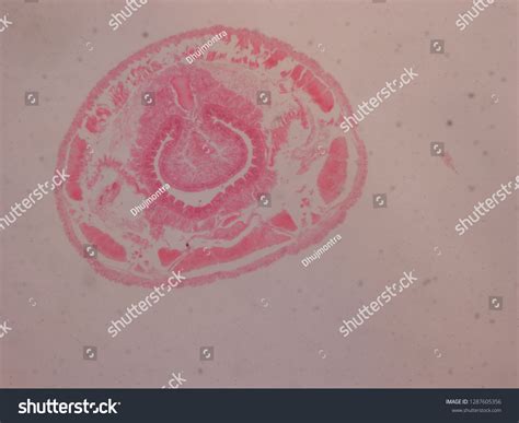 Transverse Section Earthworm Under Light Microscope Stock Photo ...