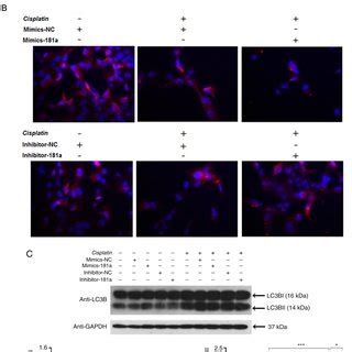 Vdr Potentially Enhances Cisplatin Chemosensitivity In Hs T Cells