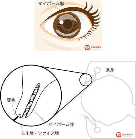 ものもらい（霰粒腫・麦粒腫） 治療メニュー だるま眼科（群馬県高崎市）