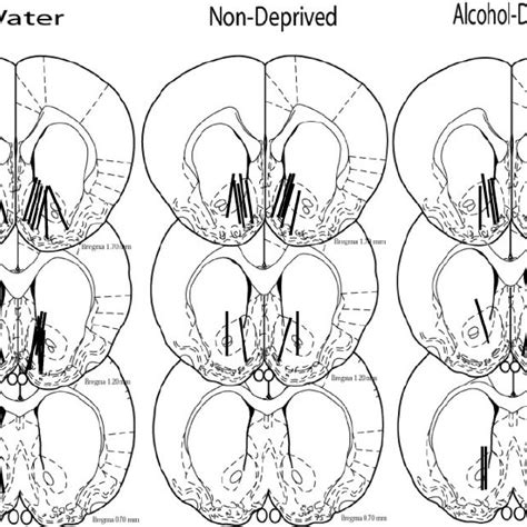 Location Of Representative Probe Placements In The Nucleus Accumbens