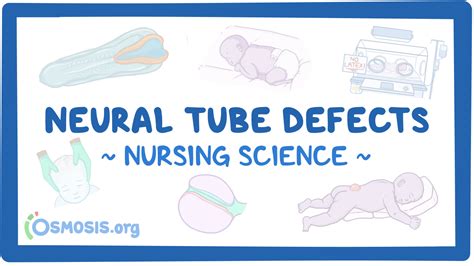 Neural Tube Defects Nursing Video Causes Osmosis