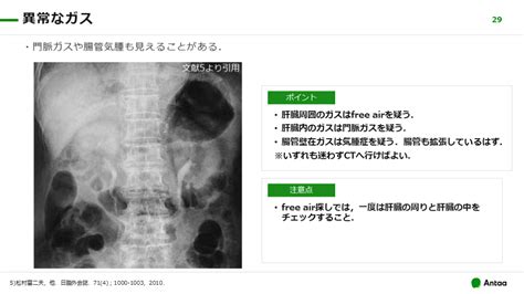 腹部単純x線腹部レントゲン どうやって使いますか？ Antaa Slide