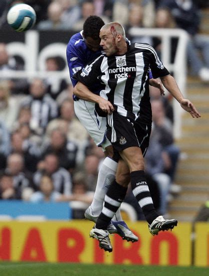 Alan Smith Newcastle United Blood Injury Editorial Stock Photo Stock