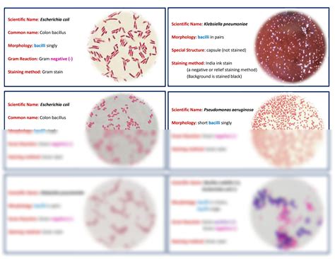 Solution Microbiology Bacteriolog Lab Practicals Studypool