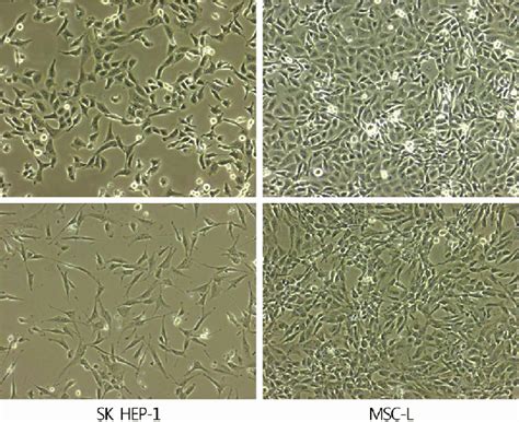 Morphology Of Sk Hep 1 Cells And Msc L Both Are Similar In Appearance