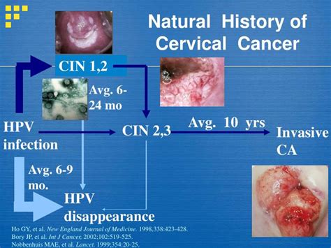 PPT - Management of Abnormal Pap Smears and Cervical Dysplasia PowerPoint Presentation - ID:1172135