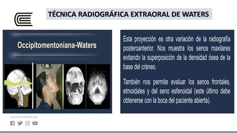 Radiografías Extraorales Youtube