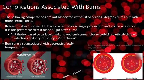 Burns Types Management Treatment And Causes Ppt