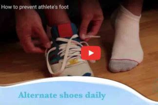 Athlete's foot | Health Navigator NZ